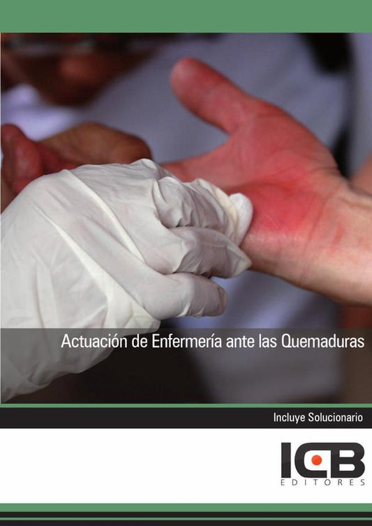 Actuación de Enfermería ante las Quemaduras